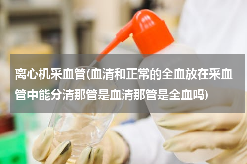 离心机采血管(血清和正常的全血放在采血管中能分清那管是血清那管是全血吗)